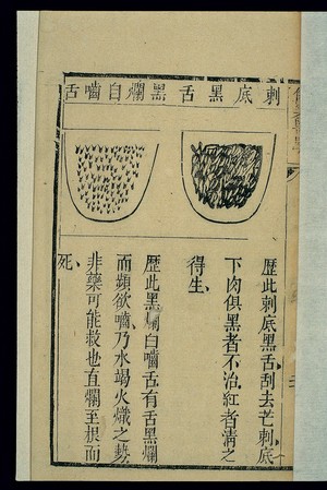 view Tongue morphology: Cidi heishe) and heilan zi nie she