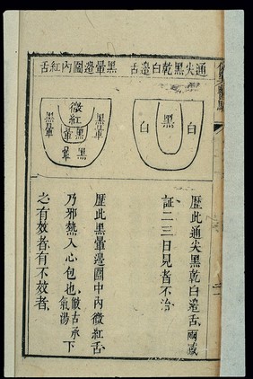 Tongue morphology, Chinese woodcut