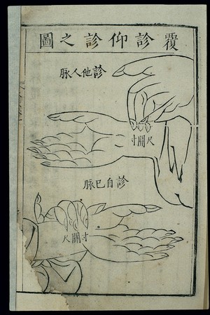 view Pulse diagnosis techniques: Fuzhen and yangzhen