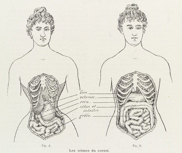 La culture physique.