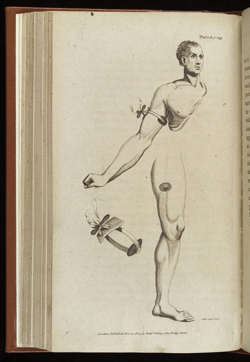 Application of tourniquet to arm and thigh, c. 1806