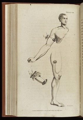 The naval surgeon; comprising the entire duties of professional men at sea. To which are subjoined, a system of naval surgery, and a compendious pharmacopoeia / [William Turnbull].