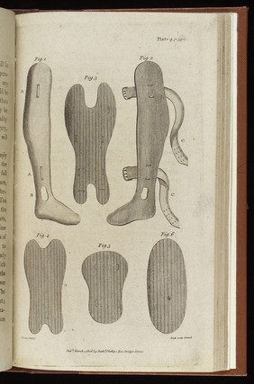 The naval surgeon; comprising the entire duties of professional men at sea. To which are subjoined, a system of naval surgery, and a compendious pharmacopoeia / [William Turnbull].