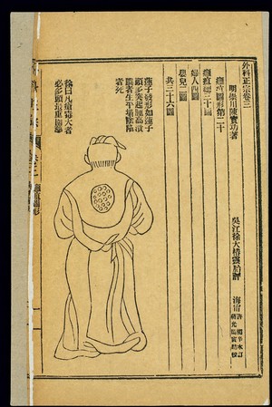 view Chinese woodcut: Abscesses -- 'Lotus Seed' abscess