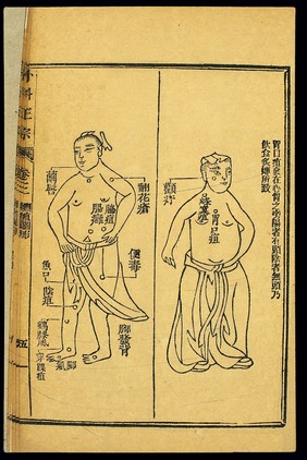 Chinese woodcut: Abscesses -- stomach-opening abscess, etc.