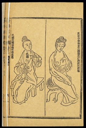 Chinese woodcut: Abscesses -- breast tumours and swellings