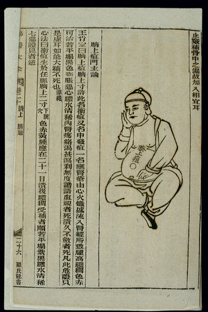 view Chinese woodcut: Abscess above the navel