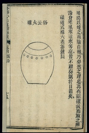 view Chinese woodcut: Medical instrument -- cupping vessel