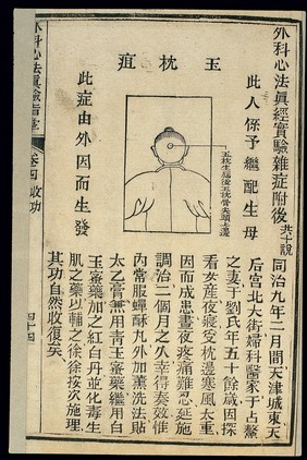 Chinese woodcut: Jade Pillow abscess