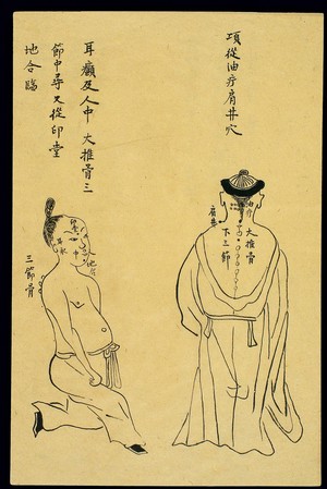 view C19 Chinese ink drawing: Boils - oily boil, ear abscess, etc.