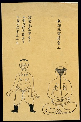 C19 Chinese ink drawing: Location of various boils