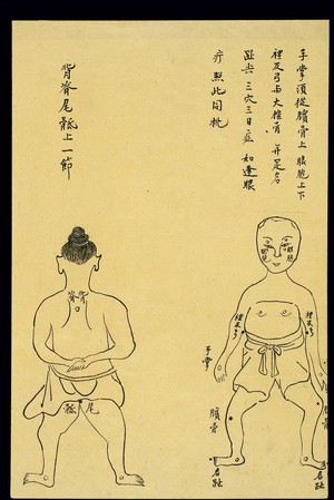 view C19 Chinese ink drawing: Location of various boils