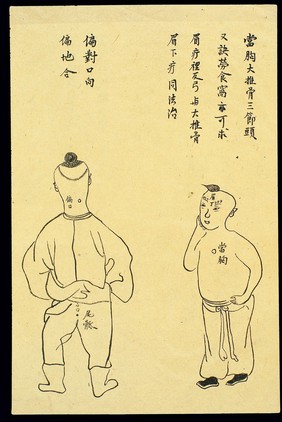 C19 Chinese ink drawing: Location of various boils