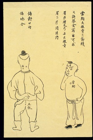 view C19 Chinese ink drawing: Location of various boils