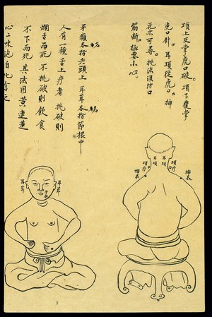 view C19 Chinese ink drawing: Location of various boils