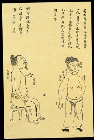 view C19 Chinese ink drawing: Location of various boils