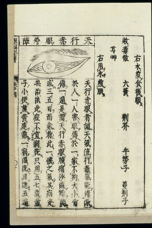 view Japanese/Chinese woodcut: Infectious 'red-eye' (chiyan)