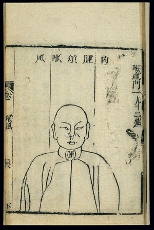 view Chinese woodcut: Pathology of 'obstructive throat wind'