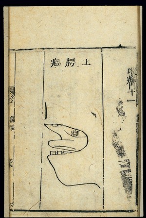 view Chinese C19 woodcut: Abscesses on the palate