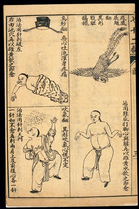 Early C20 Chinese Lithograph: 'Fan' diseases