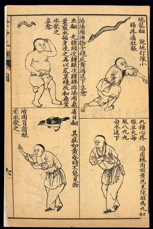 view Early C20 Chinese Lithograph: 'Fan' diseases