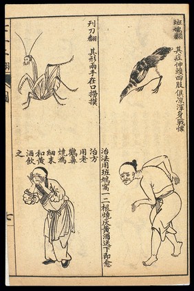 Early C20 Chinese Lithograph: 'Fan' diseases