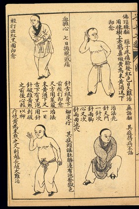 Early C20 Chinese Lithograph: 'Fan' diseases