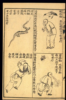 Early C20 Chinese Lithograph: 'Fan' diseases