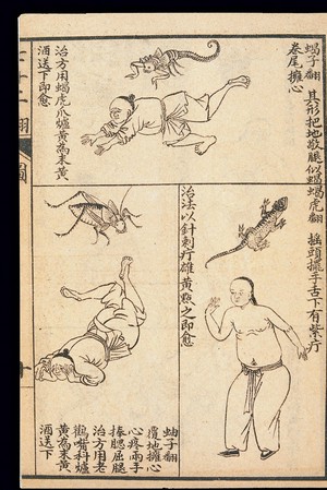 view Early C20 Chinese Lithograph: 'Fan' diseases