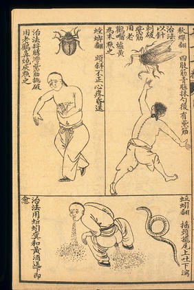 Early C20 Chinese Lithograph: 'Fan' diseases