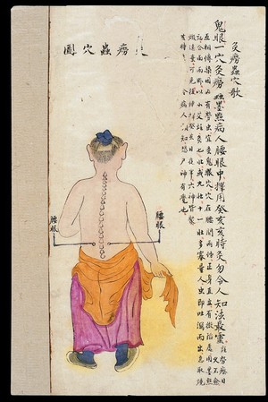 view C19 Chinese MS moxibustion point chart: Yaoyan