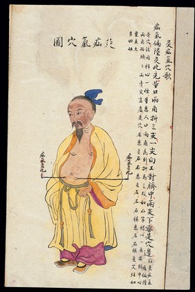 C19 Chinese MS moxibustion point chart: Hernia point