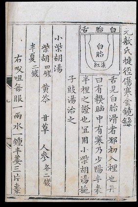 Chinese tongue diagnosis diagram: 'White-coated tongue'