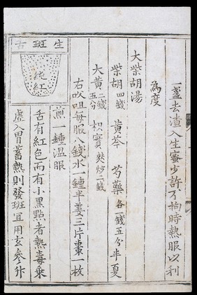 Chinese tongue diagnosis diagram: 'Spotted tongue'