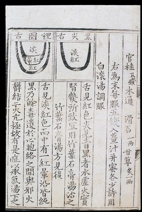 Chinese tongue diagnosis diagram