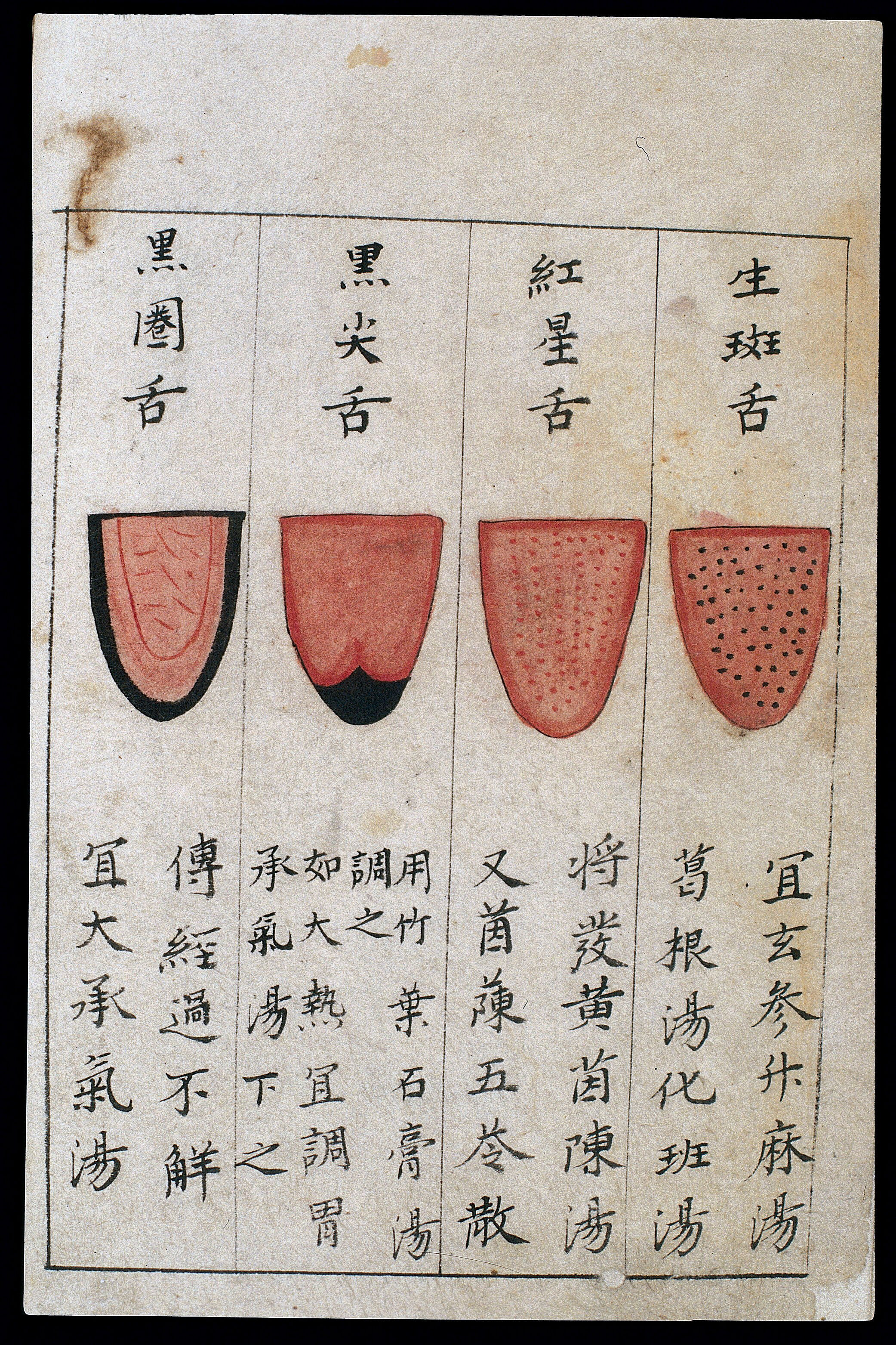 C14 Chinese tongue diagnosis chart Collection