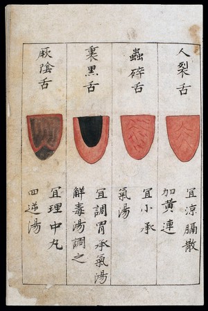 view C14 Chinese tongue diagnosis chart