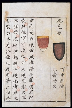 C14 Chinese tongue diagnosis chart