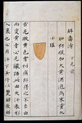 C14 Chinese tongue diagnosis chart