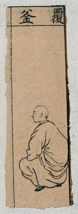 Mid C20 Chinese medical illustration in trad. style: Smallpox