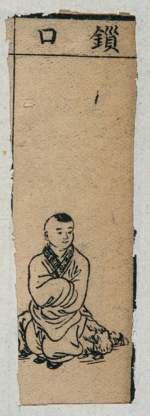 view Mid C20 Chinese medical illustration in trad. style: Smallpox