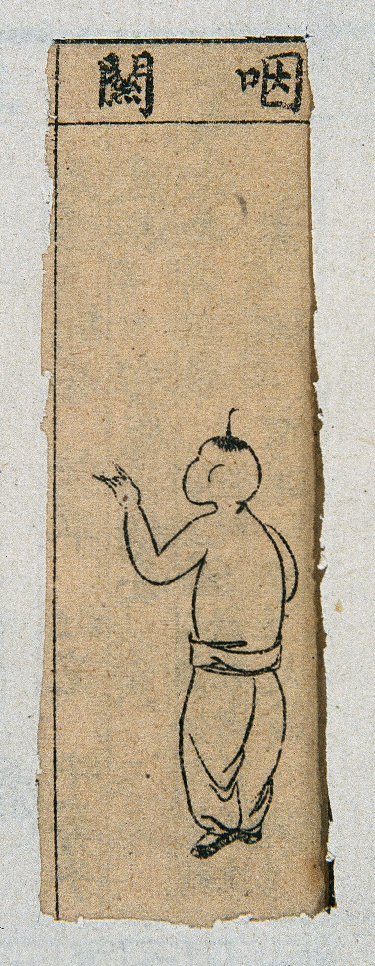 Mid C20 Chinese medical illustration in trad. style Smallpox