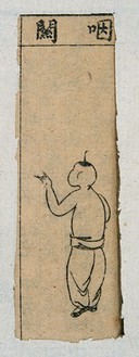 Mid C20 Chinese medical illustration in trad. style: Smallpox