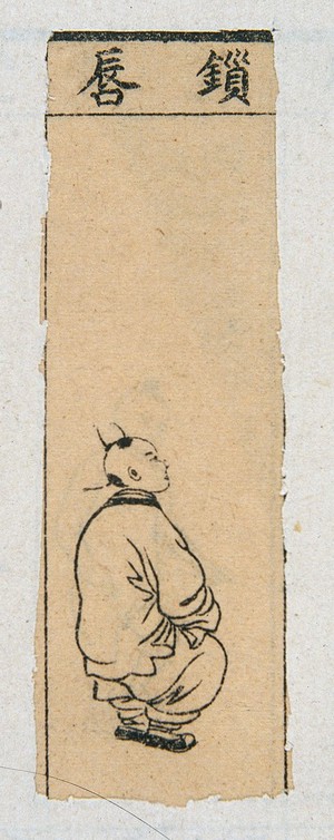 view Mid C20 Chinese medical illustration in trad. style: Smallpox