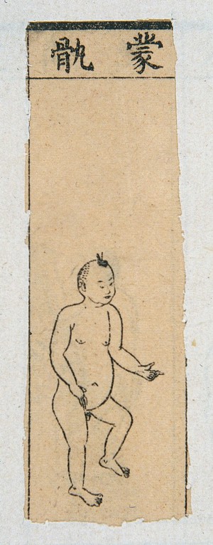 view Mid C20 Chinese medical illustration in trad. style: Smallpox