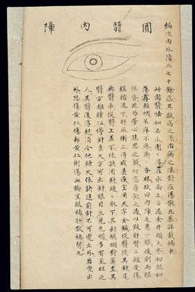 Illustration from Ming Chinese ophthalmology text, Ms copy