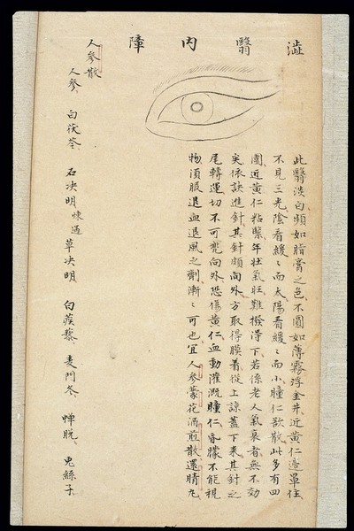 Illustration from Ming Chinese ophthalmology text, Ms copy