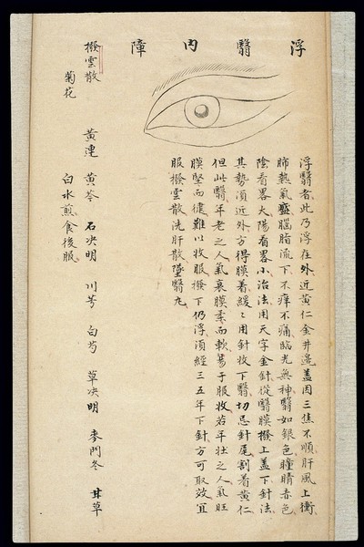 Illustration from Ming Chinese ophthalmology text, Ms copy