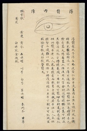 Illustration from Ming Chinese ophthalmology text, Ms copy