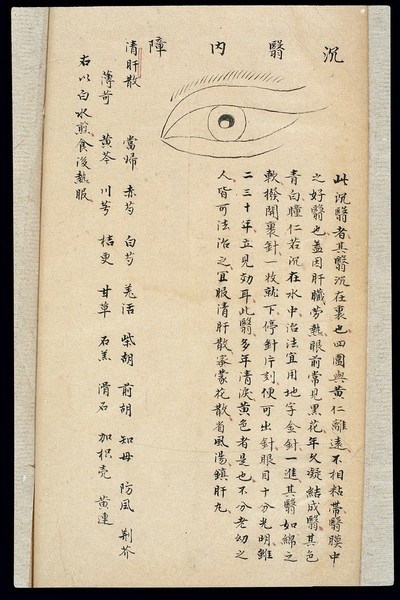 Illustration from Ming Chinese ophthalmology text, Ms copy